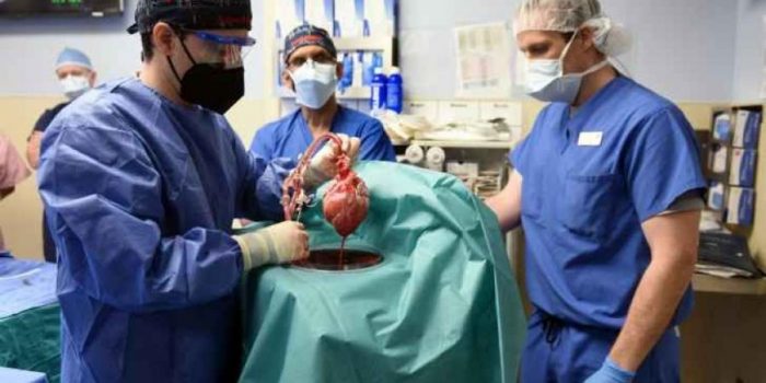 جراحون ينجحون في زراعة قلب خنزير في إنسان