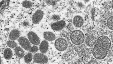 صورة مجهرية إلكترونية (EM) لجزيئات فيروس جدري القرود، عينة سريرية من جلد بشري مرتبطة بتفشي كلاب البراري عام 2003. الصورة غير مؤرخة نشرت في 18 ماي 2022