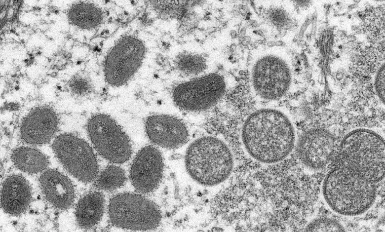 صورة مجهرية إلكترونية (EM) لجزيئات فيروس جدري القرود، عينة سريرية من جلد بشري مرتبطة بتفشي كلاب البراري عام 2003. الصورة غير مؤرخة نشرت في 18 ماي 2022